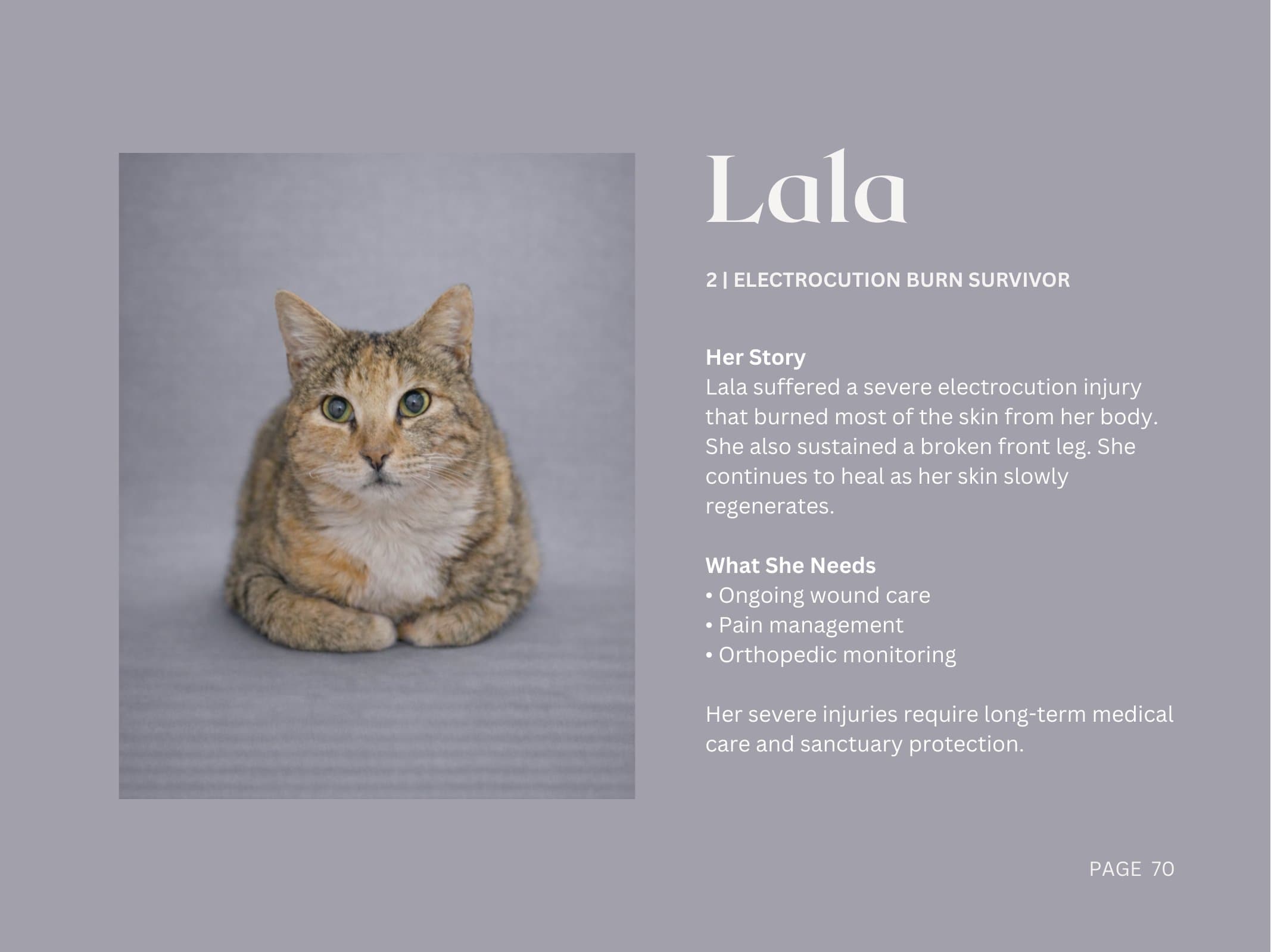 Lala — Electrocution Burn Survivor