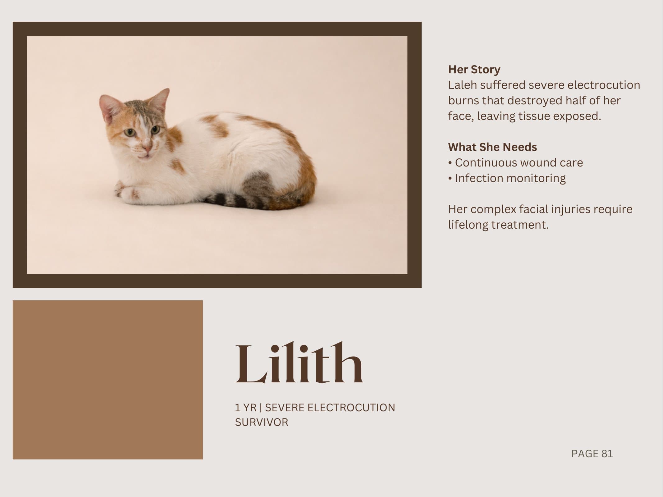 Lilith — Severe Electrocution Survivor